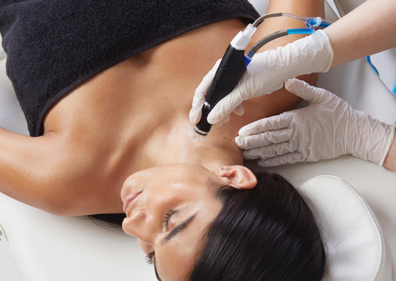 Hydrafacial Behandlung am Dekolleté
